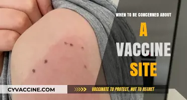 Vaccine Site Reactions: When to Seek Medical Attention