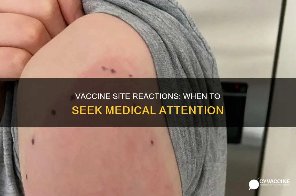 when to be concerned about a vaccine site