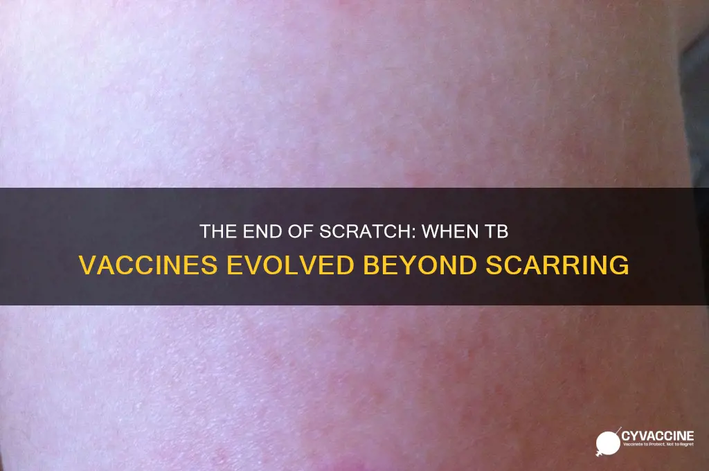 when was the scratch version of tb vaccine phased out