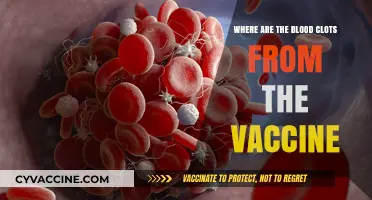 Vaccine-Related Blood Clots: Understanding Their Origin and Risks