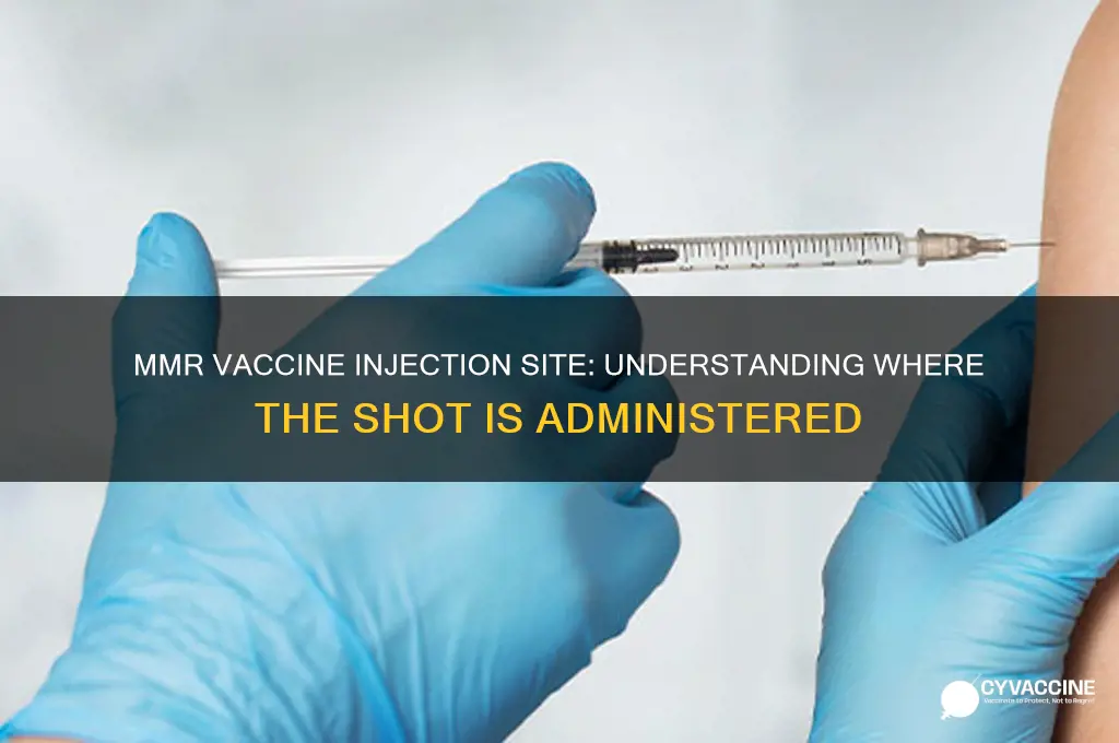 where is the mmr vaccine injected