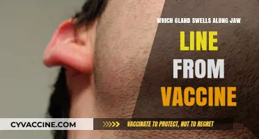 Vaccine-Related Jaw Swelling: Understanding the Swollen Gland Phenomenon
