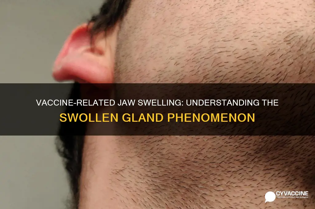 which gland swells along jaw line from vaccine