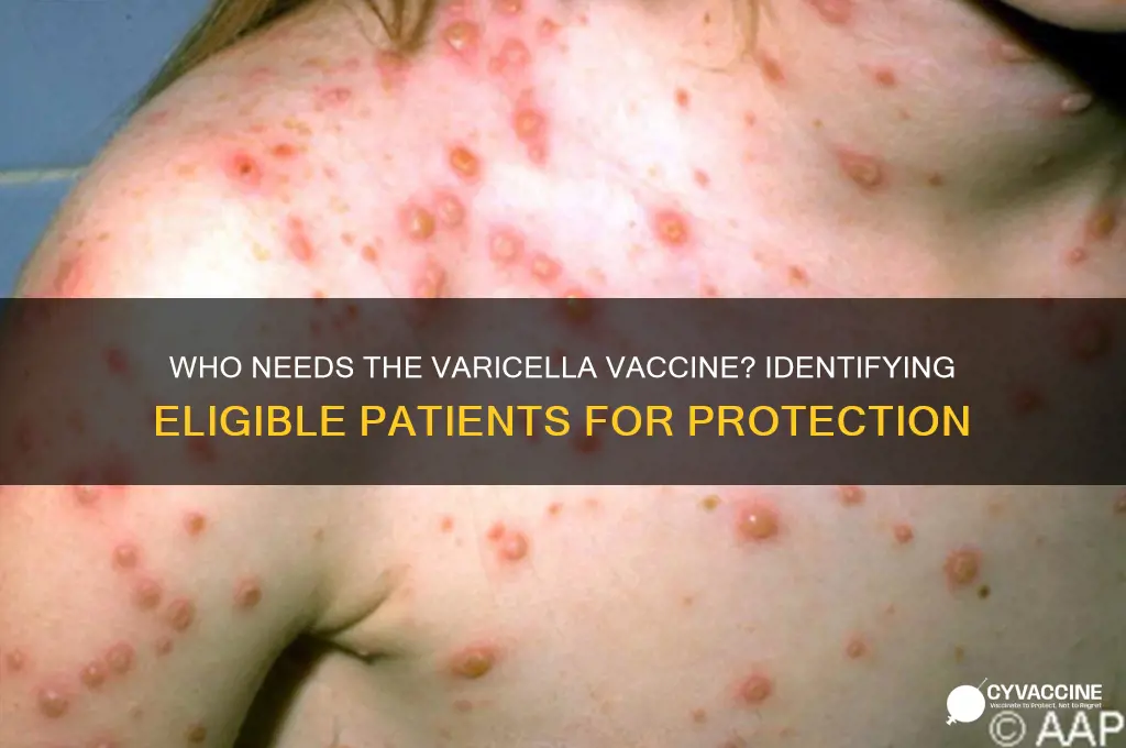 which of the following patients should receive the varicella vaccination