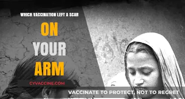 The Smallpox Vaccine Scar: A Mark of Immunity and History