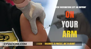 Vaccination Marks: The Arm Imprint That Tells a Health Story