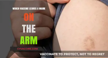 Vaccine Marks: Which Shot Leaves a Visible Arm Scar?