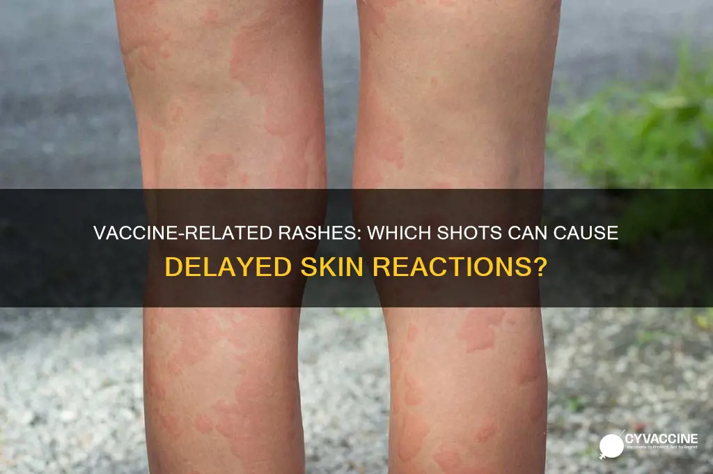 which vaccines casue a rash 1 month later