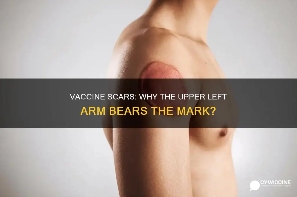 which vaccines left scar on upper left arm