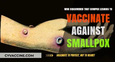 Cowpox's Role: The Discovery of Smallpox Vaccination by Jenner