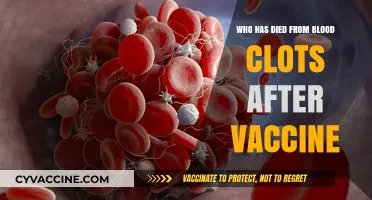 Blood Clots Post-Vaccination: Investigating Rare Fatal Cases and Risks