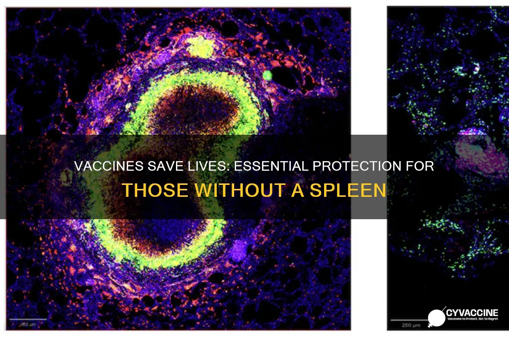 why are vaccines important for someone without a spleen