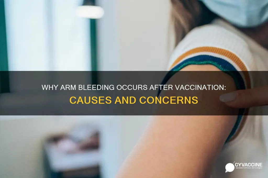 why did my arm bleed after a vaccine