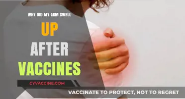 Arm Swelling After Vaccines: Causes, Concerns, and When to Seek Help