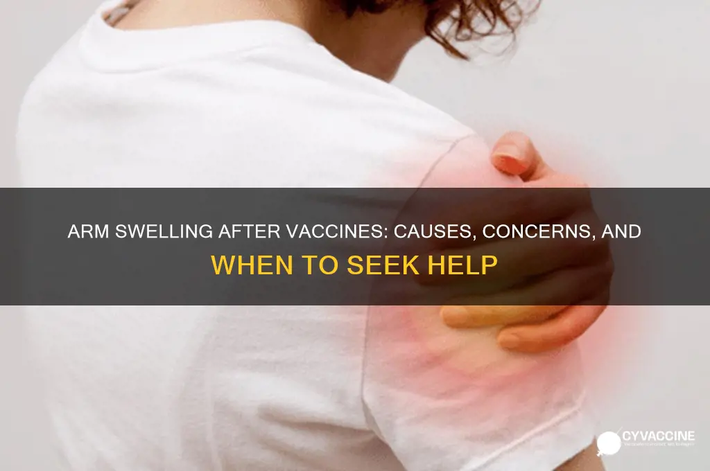 why did my arm swell up after vaccines