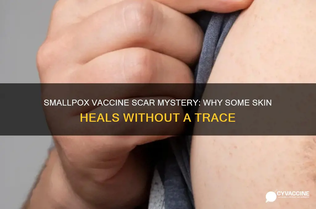 why did my smallpox vaccine not leave a scar