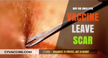 Why Smallpox Vaccines Left Scars: Understanding the Mark of Immunity