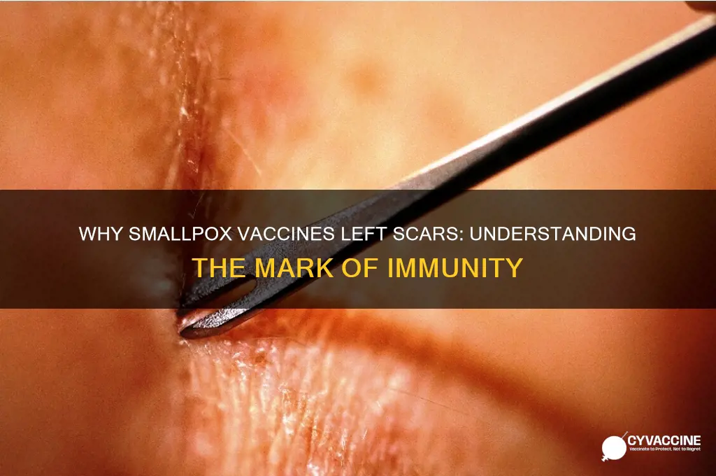 why did smallpox vaccine leave scar