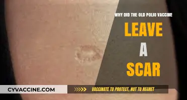 The Lasting Mark: Why the Old Polio Vaccine Left a Scar