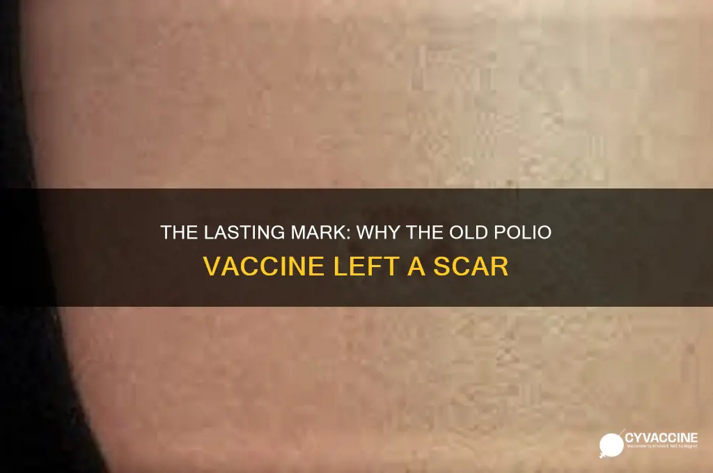why did the old polio vaccine leave a scar