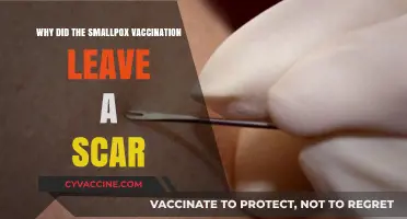 Smallpox Vaccination Scars: Why They Were Left Behind