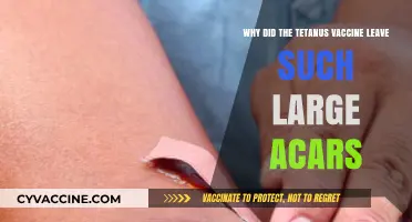 Tetanus Vaccine Scars: Understanding the Large Marks Left Behind
