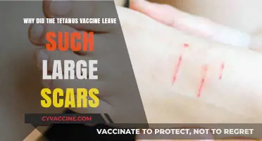Tetanus Vaccine Scars: Unraveling the Mystery Behind Their Size