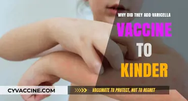 Varicella Vaccine in Kinder: Protecting Kids from Chickenpox Early