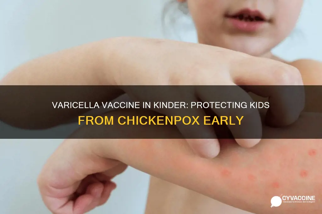 why did they add varicella vaccine to kinder