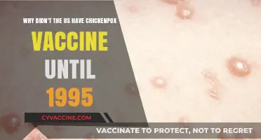 Delayed Defense: Why the US Chickenpox Vaccine Arrived in 1995