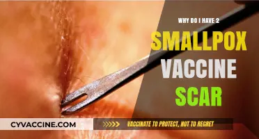 Understanding the Dual Smallpox Vaccine Scar: A Historical Health Mark