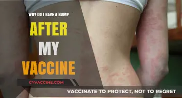 Post-Vaccine Bump Explained: Causes, Concerns, and When to Seek Help