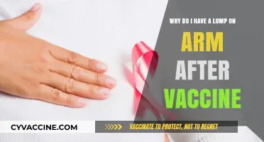 Arm Lump After Vaccine: Causes, Concerns, and When to Seek Help