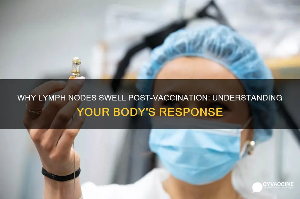 why do lymph nodes swell after a vaccine