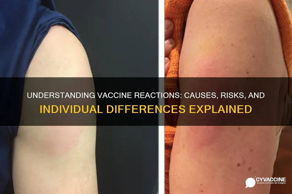 why do some have bad reaction to vaccine