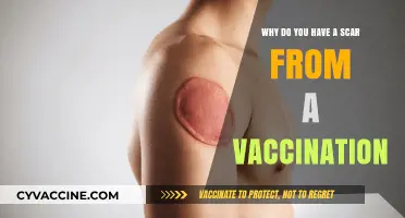 Vaccination Scars Explained: Why Some Shots Leave Lasting Marks