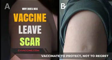 Why BCG Vaccines Often Leave a Lasting Scar Explained