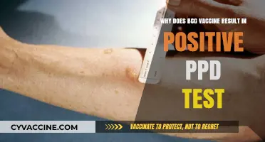 BCG Vaccine and PPD Test: Understanding the Positive Result Connection
