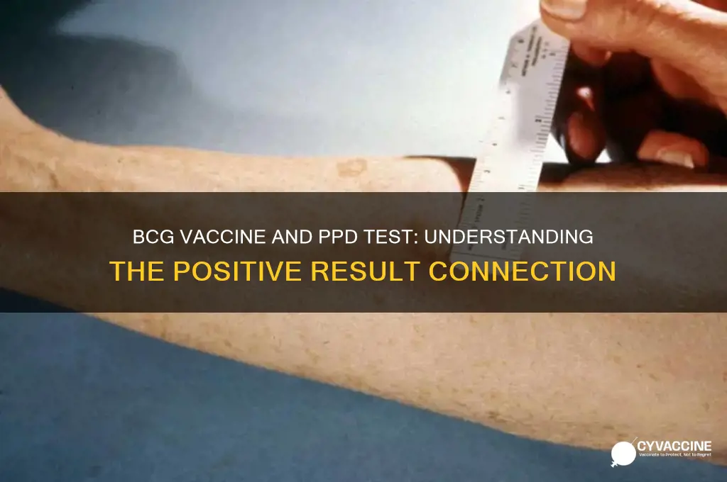 why does bcg vaccine result in positive ppd test