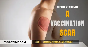 Understanding the Story Behind My Mom's Vaccination Scar