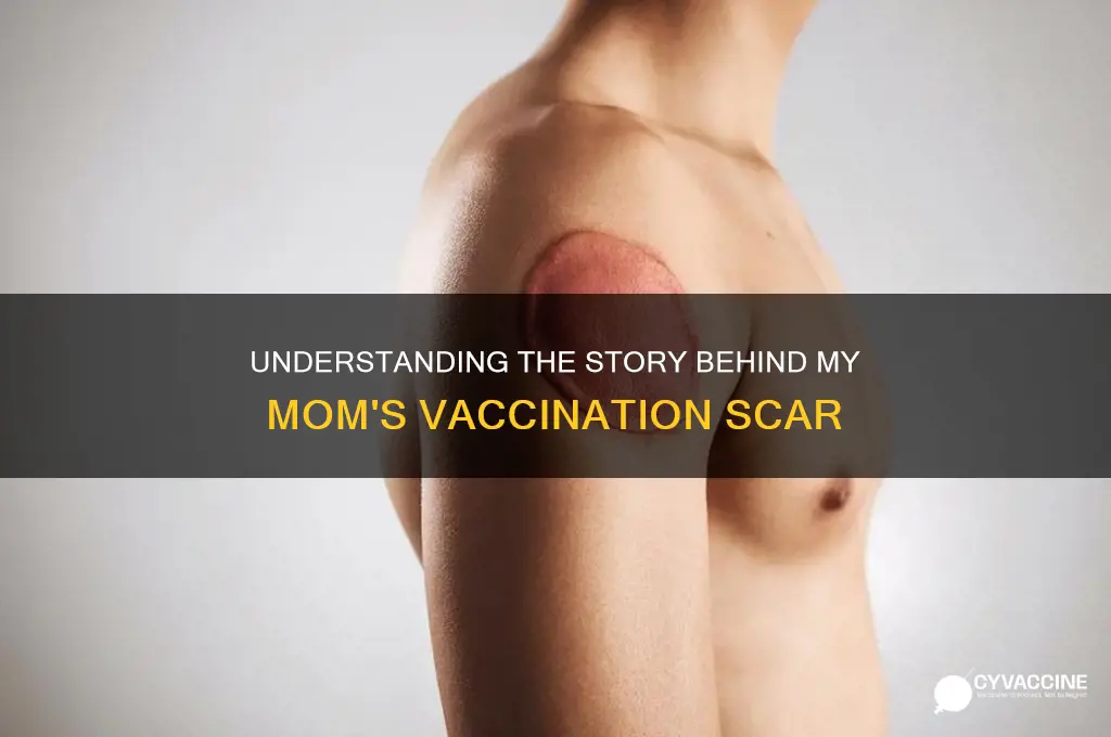why does mt mom jave a vaccination scar