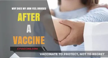 Post-Vaccine Arm Soreness: Understanding Bruise-Like Symptoms and Causes