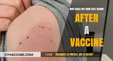 Why Your Arm Feels Warm After a Vaccine: Explained