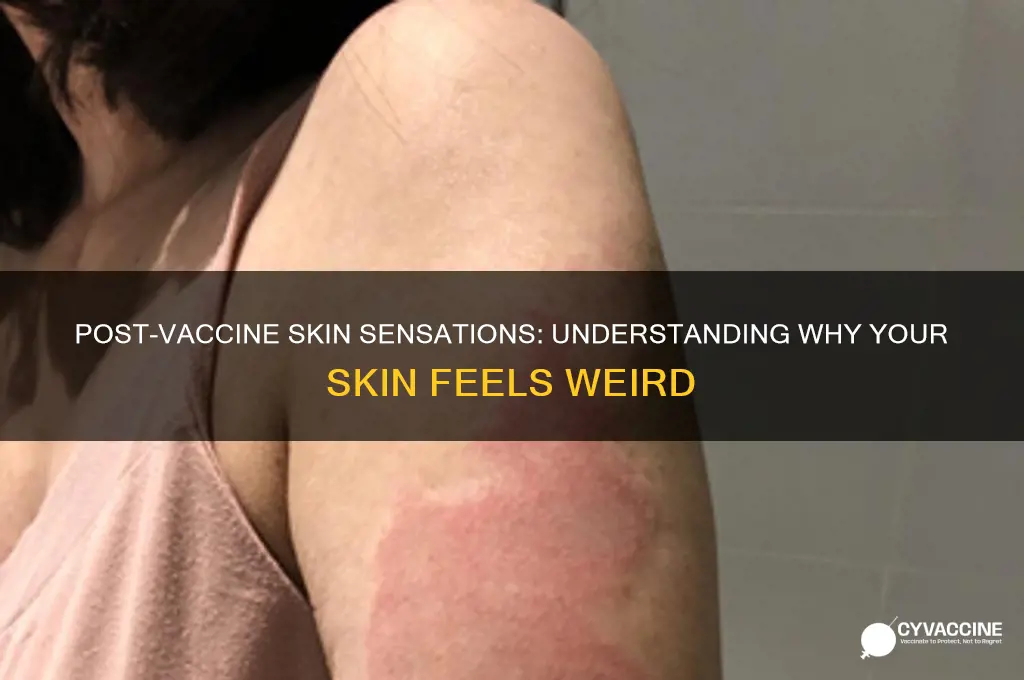 why does my skin feel weird after a vaccine