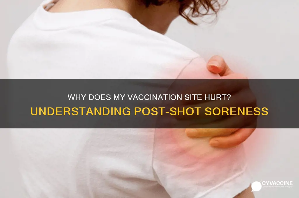 why does the area where i got vaccinated hurt
