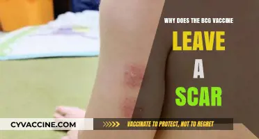 The BCG Vaccine: Why Does It Leave a Mark?