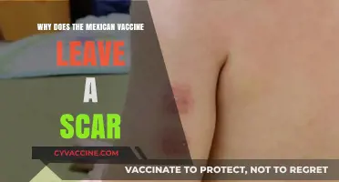 Why Mexico's BCG Vaccine Leaves a Distinct Scar Explained
