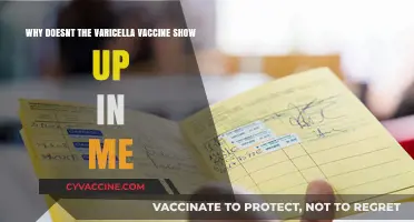 Why Varicella Vaccine May Not Appear in Your Medical Records