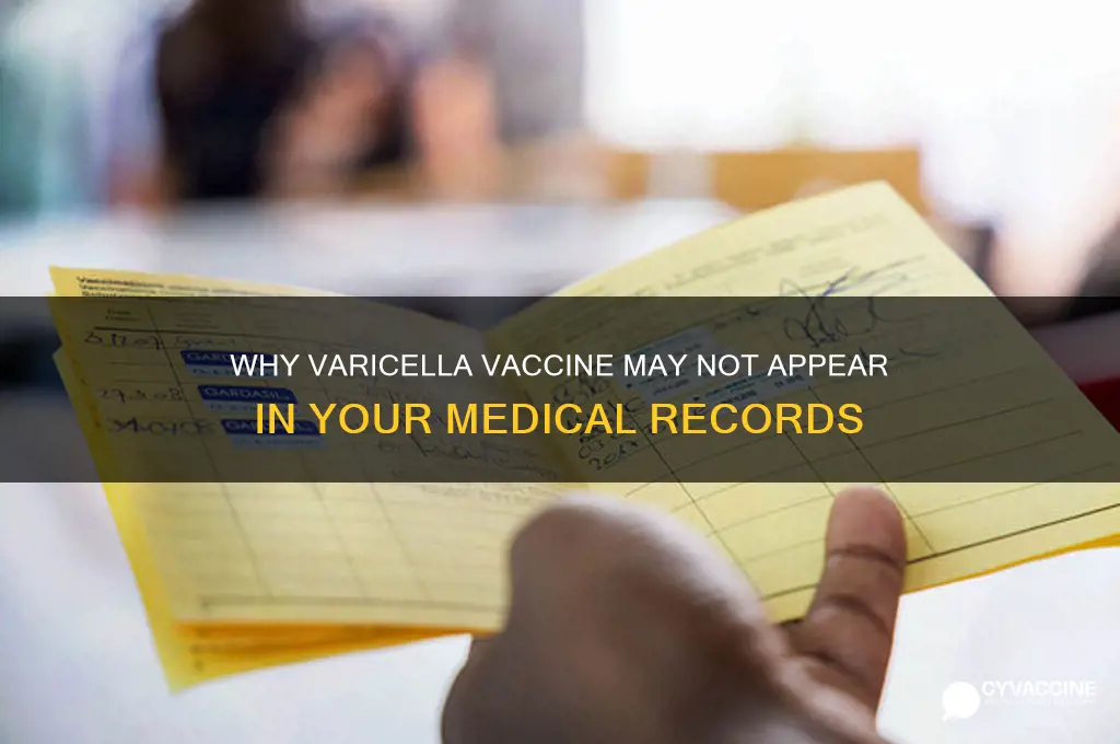 why doesnt the varicella vaccine show up in me