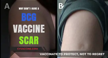 Why Some People Lack a BCG Vaccine Scar: Unraveling the Mystery
